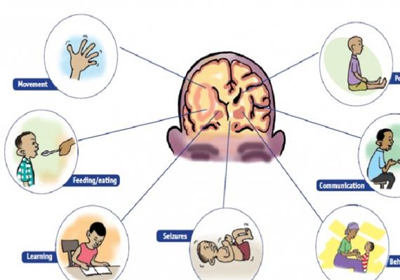 Intouduction to Cerebral Palsy